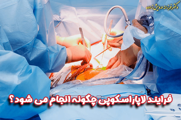 لاپاراسکوپی - دکتر فرزانه درویش زاده