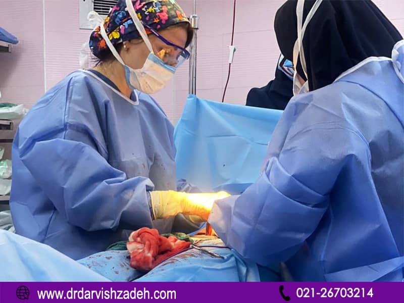 جراحی میومکتومی چیست؟