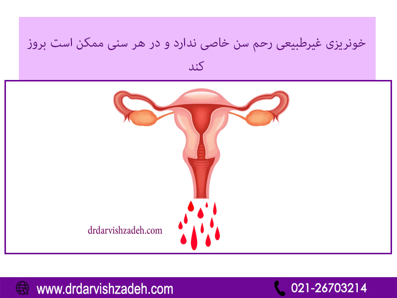خونریزی غیر طبیعی رحمی - دکتر درویش زاده