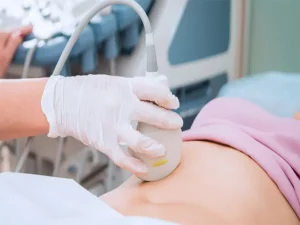 بارداری پوچ - دکتر درویش زاده