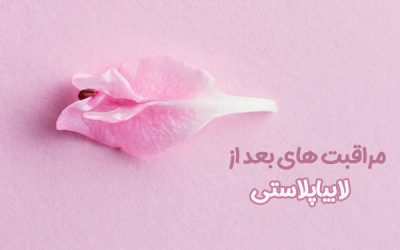 مراقبت های بعد از لابیاپلاستی + ناگفته های بعد از عمل