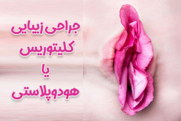 جراحی زیبایی کلیتوریس یا هودوپلاستی - دکتر درویش زاده
