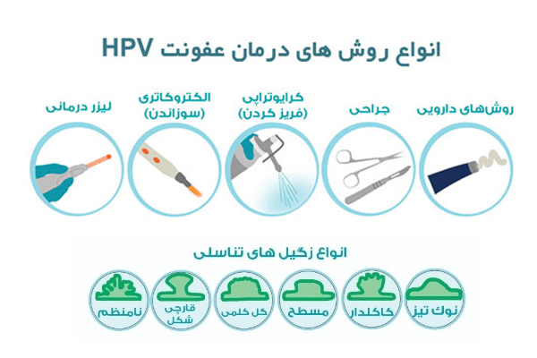 زگیل تناسلی - دکتر درویش زاده