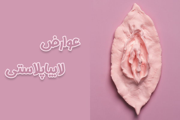 عوارض لابیاپلاستی - دکتر فرزانه درویش زاده