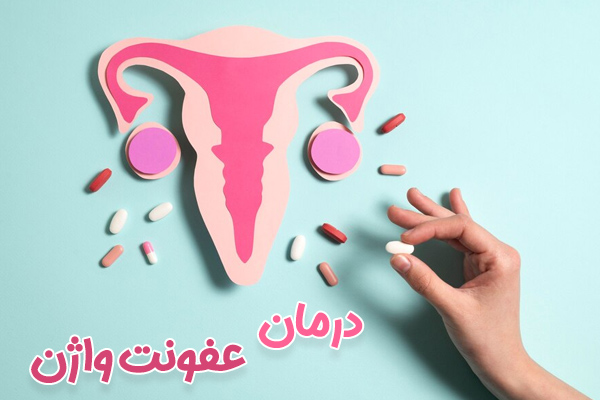 درمان عفونت واژن - دکتر درویش زاده