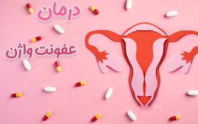 درمان عفونت واژن