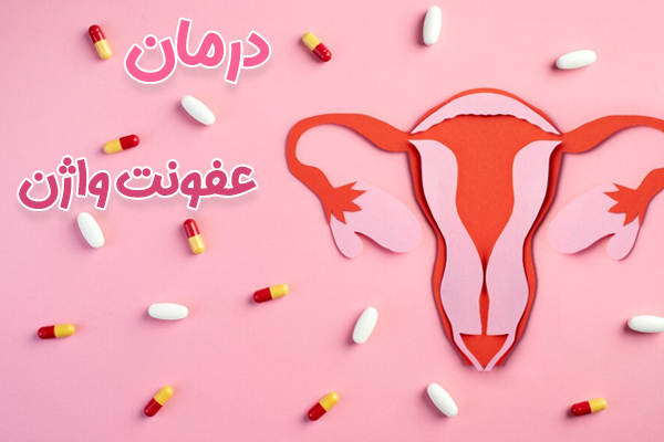 درمان عفونت واژن - دکتر درویش زاده