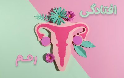 افتادگی رحم | درمان پرولاپس رحم