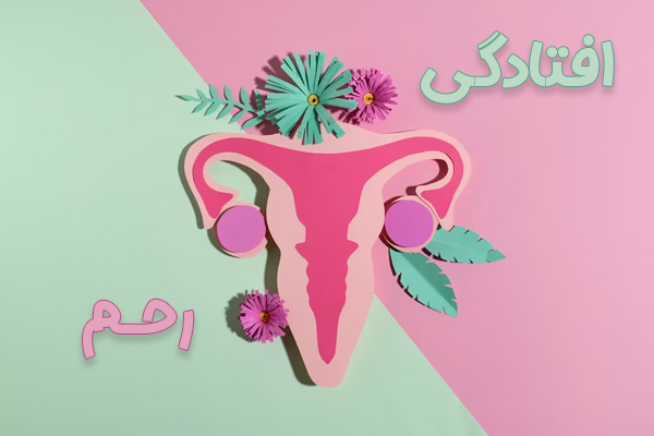 افتادگی رحم | درمان پرولاپس رحم