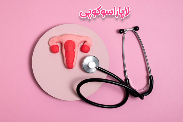 لاپاراسکوپی رحم - دکتر درویش زاده