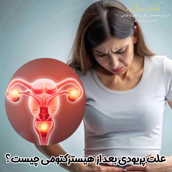 علت پریودی بعد از هیسترکتومی با دکتر فرزانه درویش زاده 