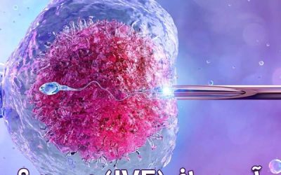 آی وی اف (IVF) چیست ؟