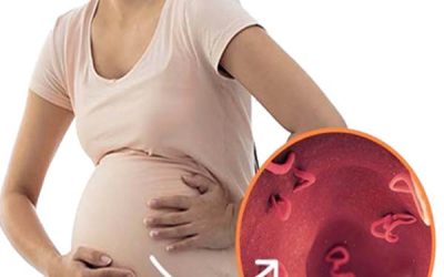 بارداری بعد از عمل میومکتومی