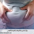 بزرگ شدن شکم بعد از هیسترکتومی