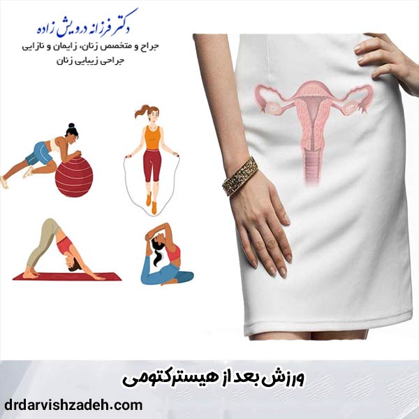 ورزش بعد از هیسترکتومی با دکتر فرزانه درویش زاده
