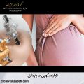 لاپاراسکوپی در بارداری
