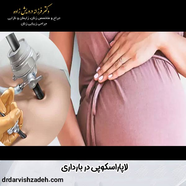 لاپاراسکوپی در بارداری - دکتر فرزانه درویش زاده