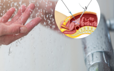 حمام بعد از لاپاراسکوپی