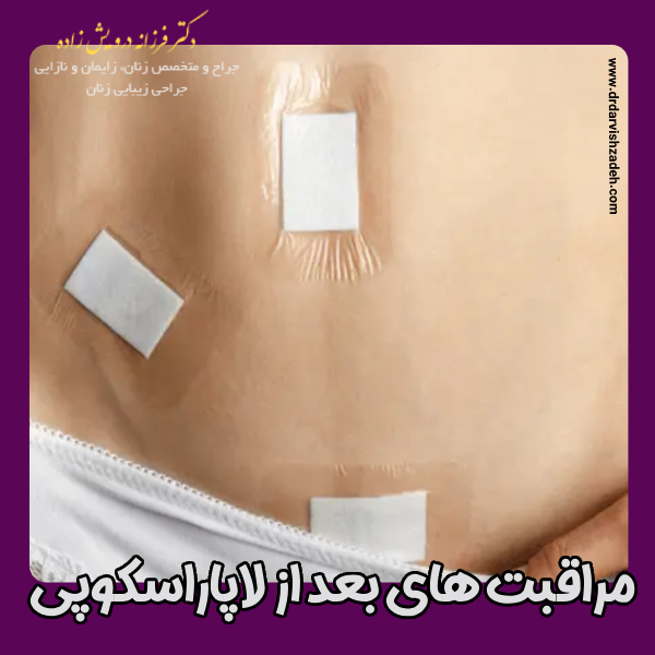 مراقبت های بعد از لاپاراسکوپی - دکتر فرزانه درویش زاده